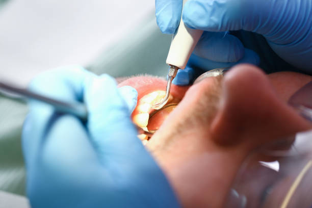 Best Pediatric Emergency Dentist in North Yelm, WA